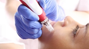 Za savršenu kožu bez bora, hiperpigmentacije ili akni! Zablistajte u trenu tretmanom dermapena s koktelima, maskom i masažom u Kozmetičkom Studio Sensa u Puli uz 60% popusta – samo 279 kn!