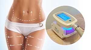 Zamrznite masne naslage i pohvalite se super rezultatima! Natural Body and Soul nudi kriolipoliza paket- 4 sonde cryo shape na željene zone u jednom dolasku i 3 dolaska za samo 999 kn!