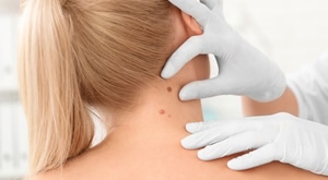 Briga o madežima i prevenciji tegoba jednostavnija je uz dermatoskopski pregled u Poliklinici LabPlus Zagreb! Pregledajte tijelo, vlasište i madeže na vrijeme, uz čak 50% popusta!
