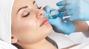 [NOVO] Brinite o svom izgledu! Korekcija sitnih nepravilnosti – nazolabijala ili povećanje usnica u stomatološkoj ordinaciji Antonijela Vacula u Zagrebu uz 1 ml hijaluron filera, samo 1299 kn!