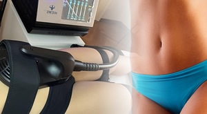 Vježbajte bez znojenja i muke! Uređaj najnovije generacije koji vježba vaše mišiće za Vas – TESLA EM SCULPT – u Luce Beauty u Rijeci! Izaberite 2, 5, 10 ili 20 tretmana već od samo 359 kn!