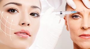 NOVO – vratite mladost i sjaj kože svoga lica i smanjite bore! OzonM u Zagrebu i dr. Džaja donose Vam botox tretman jedne ili tri regije lica uz do 50% popusta!