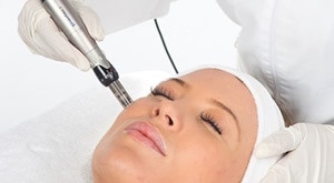 Podarite koži elastičnost, obnovite kolagen i vratite mladenački sjaj u Salonu LaVi u Zagrebu: UZV špatula + dermapen ili kemijski piling + mikrodermoabrazija + dermapen, uz 55% POPUSTA!