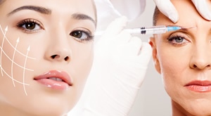 Vratite mladost i sjaj kože svoga lica i smanjite bore! OzonM u Zagrebu i dr. Džaja donose Vam botox tretman jedne ili tri regije lica uz do 50% popusta!