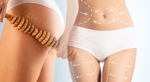 Beauty salon LaVi u Zagrebu predstavlja Vam veliki paket mršavljenja i oblikovanja tijela od 30 tretmana uz 62% popusta – piling, maderoterapija, anticelulitna masaža, body wrapping i termodeka!