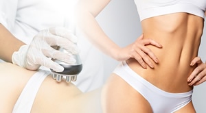 Vrtoglavih 80% popusta na veliki paket mršavljenja – 32 vrhunska tretmana oblikovanja tijela u salonu Bio+klinik u Zagrebu!