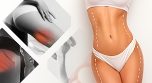 Gradnja mišićne mase i otapanje suvišnih masnoća istovremeno – 58% popusta na paket od 10 TESLA tretmana u salonu Bio+klinik na 2 lokacije u Zagrebu!