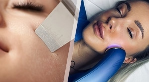 Besprijekorno lice uz fantastične ponude aOra Beauty Awareness u Zagrebu – izaberite Ultrasonic cleanse ili LED terapiju u pola cijene za čvršću i sjajniju kožu lica!