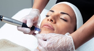 Trenutni sjaj i blistavost kože uz poticanje proizvodnje kolagena i regeneraciju u aOra BEAUTY LOUNGE u Zagrebu (Cvjetni) – microneedling paket od 6 tretmana s hidrodermoabrazijom i luksuznom njegom!