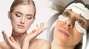 NOVO i prvi put na Crnom Jaju – čarolija zatezanja lica bez igle EmFace tretmanom u Bio+ klinik salonu u Zagrebu za odabrano područje već od samo 55 eura!