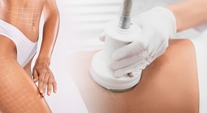 Pink Beauty centrar iz Zagreba donosi jedan od najpopularnijih tretmana za mršavljenje i oblikovanje tijela – ULTRACONTOUR, koji kombinira čak 6 djelotvornih metoda!