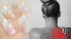 NOVO! Hidžama – cupping terapija za detoksikaciju! Iskoristite blagodati hidžama terapije za  detoksikaciju, smanjenje bolova i upala, snižavanje krvnog tlaka te jačanje imunološkog sustava.