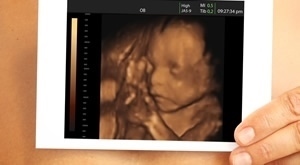 [UZV BEBE] Ostvarite 43% popusta na 4D ultrazvuk i DVD snimku svoje bebe uz uključen anomaly scan u Poliklinici dr. Đurića u Zagrebu!