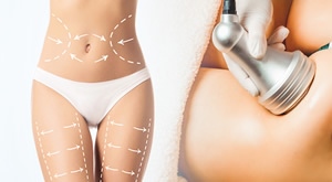 Otopite masnoće kavitacijom, napravite limfnu drenažu, učvrstite kožu radiofrekvencijom i poboljšajte elastičnost vakumom u Skin Glow Beauty Salonu u Splitu uz M , L ili XL paket mršavljenja!