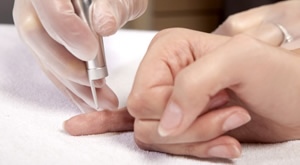 Uklonite neželjene bradavice laserom, biolaserom ili ozonom uz Beauty Centru Kozlinger!