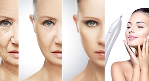 Beauty Centar Kozlinger u Zagrebu: PLASMA PEN = tajna zategnute kože za ujednačen ten bez bora! 