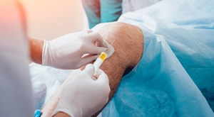 Spas za bolna koljena - Poliklinika VitalArt iz Zagreba donosi terapiju HIJARULONSKOM KISELINOM!