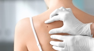 Uklanjanje madeža, bradavica ili lipoma uz dermatoskopski pregled u Poliklinici Superiora u Zagrebu!