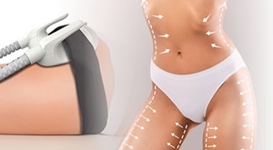 Salon Val Beauté: Tesla RF, Green laser i maderoterapija – mršavljenje u samo 6 dolazaka!