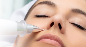 PLASMA PENOM protiv bradavica, fibroma i keratoza u Beauty centru Kozlinger!