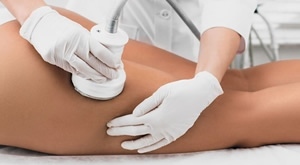 Beauty salon LaVi u Zagrebu - MAX SHAPE paket od 31 tretmana protiv viška kilograma i celulita!