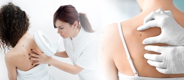 Uklonite madeže, bradavice ili lipome SIGURNO i BEZBOLNO. Vrhunska dermatoskopija i LOKALNA ANESTEZIJA u Poliklinici Superiora ZAGREB osiguravaju BRZ zahvat i estetski NAJBOLJI REZULTAT!