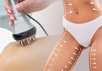 Val Beauté Zagreb: Tesla Body Sculpt + RF paket 10+2 GRATIS. 4 ručke za max rezultat i oblikovanje! 